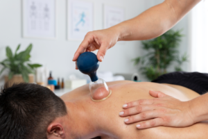 Cupping